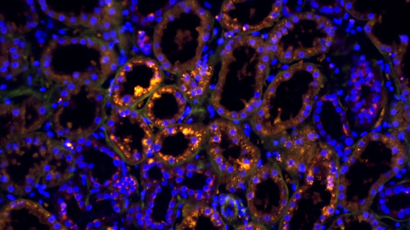OPG Staining